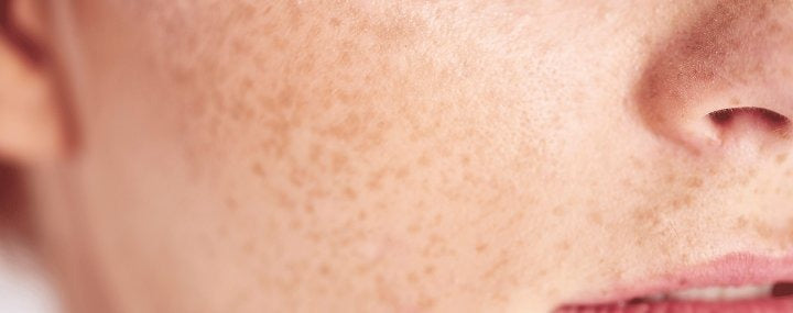 Détails de la peau sensible - 🌿 Peaux sensibles : les meilleures marques coréennes à adopter.